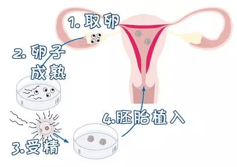 孕妇生产